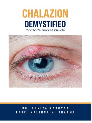 cover image of Chalazion Demystified